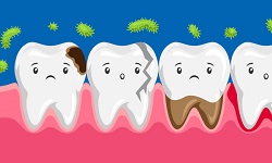 Oral infections